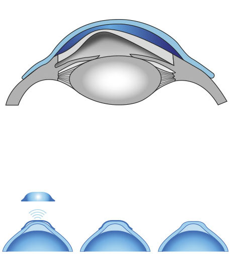 ortoQUE01